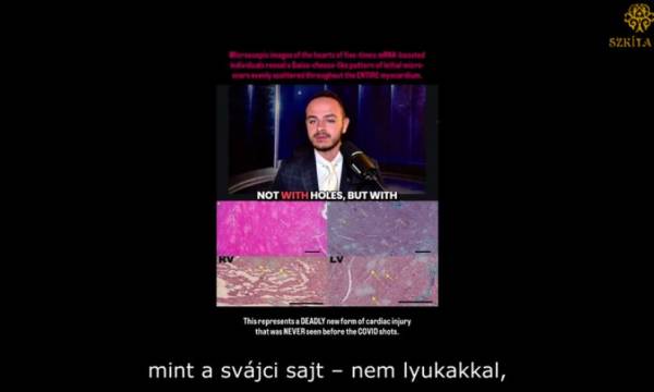 Boncolási tanulmány az mRNS-oltásokról