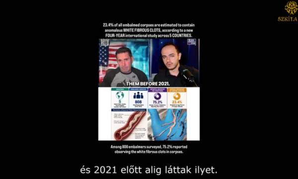 Minden negyedik holttestben furcsa vérrögöket találtak a balzsamozók